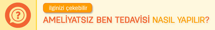 ben tedavisi