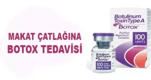 makat çatlağı botoks tedavisi